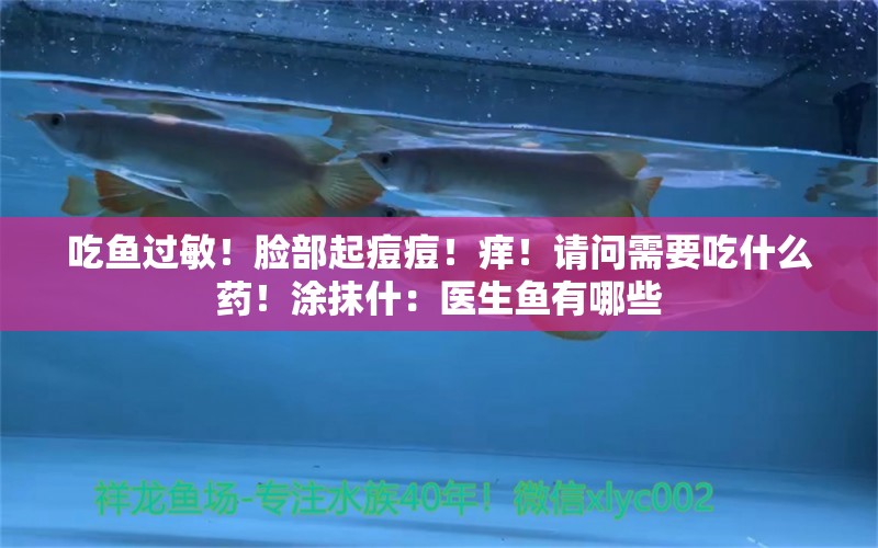 吃魚過敏！臉部起痘痘！癢！請問需要吃什么藥！涂抹什：醫(yī)生魚有哪些 觀賞魚