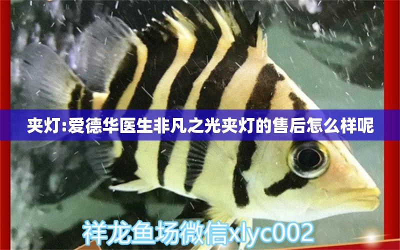 夾燈:愛(ài)德華醫(yī)生非凡之光夾燈的售后怎么樣呢