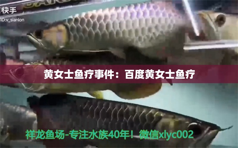 黃女士魚療事件：百度黃女士魚療 龍魚芯片掃碼器