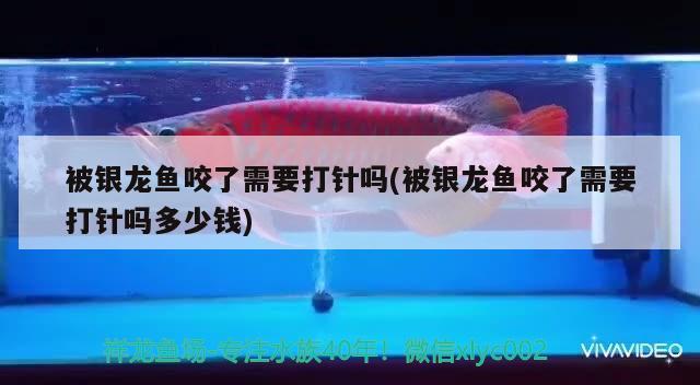 被銀龍魚咬了需要打針嗎(被銀龍魚咬了需要打針嗎多少錢)