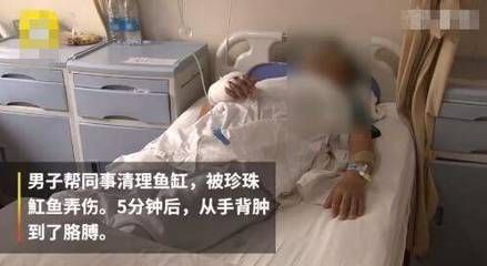 魟魚扎傷腫了怎么辦：被魟魚扎傷并且出現腫脹現象時是基于搜索結果的一些建議 魟魚百科 第3張