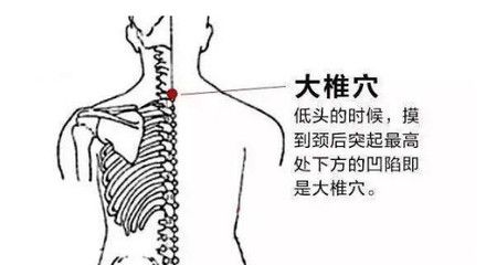 龍魚頭朝下尾巴朝上怎么治：龍魚頭朝下尾巴朝上怎么辦 龍魚百科 第2張