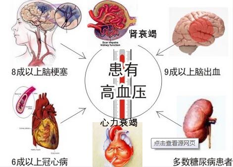 高血壓可以吃龍魚嗎：高血壓患者可以吃龍魚嗎？ 龍魚百科