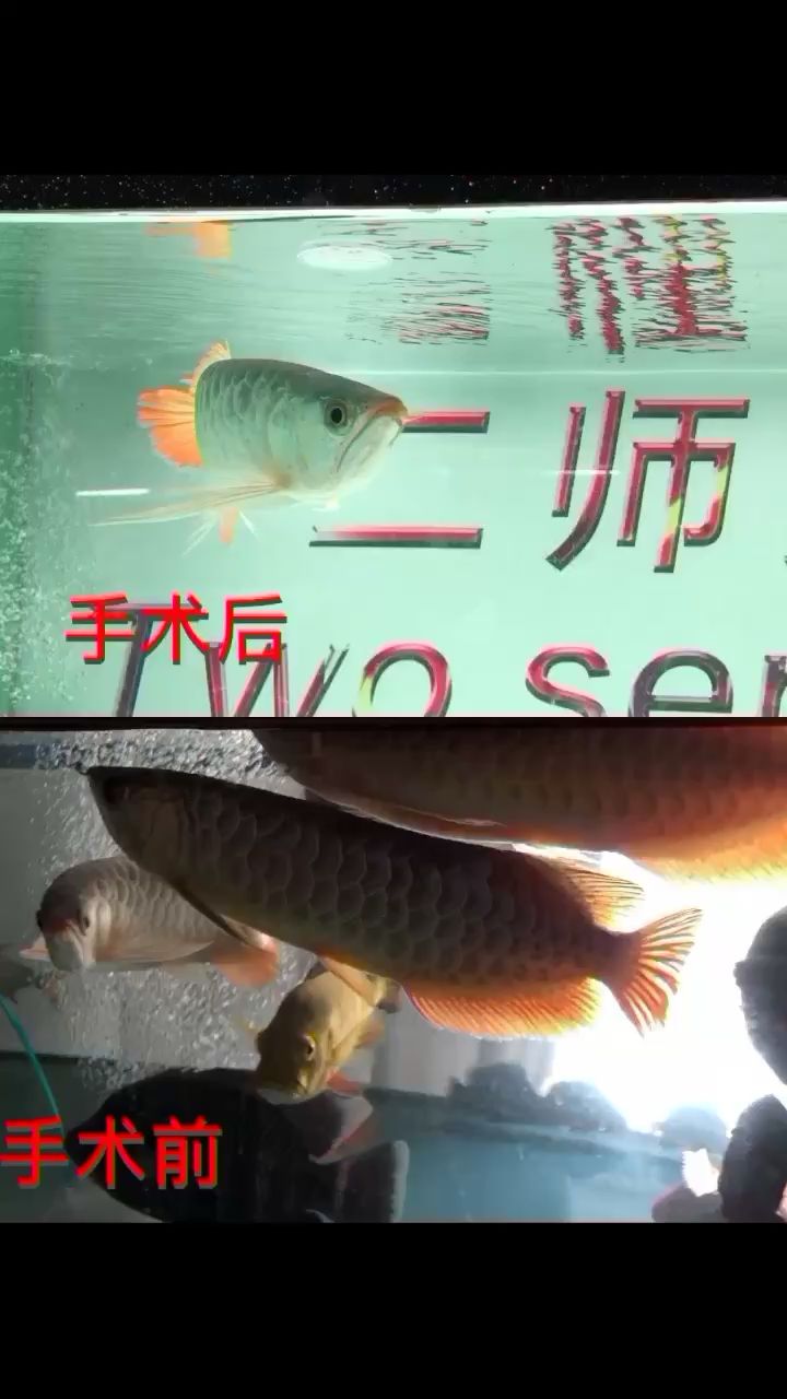 整形記??掉眼手術(shù)第三天 白寫錦鯉魚 第3張