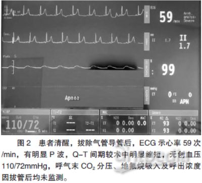 MS-222麻醉效果對比研究，ms-222與其他麻醉劑對比研究