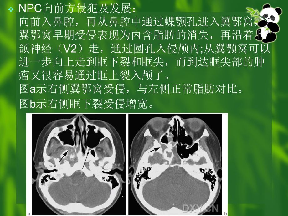 龍魚爛鼻孔：如何判斷龍魚爛鼻孔的嚴重程度 龍魚百科 第3張