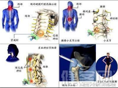 現(xiàn)代疼痛治療技術(shù)對(duì)比：現(xiàn)代疼痛治療技術(shù) 其他寵物 第6張