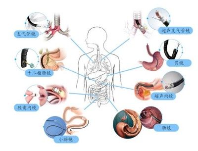 十二指腸液檢查的操作流程：十二指腸檢查的操作流程 其他寵物 第3張