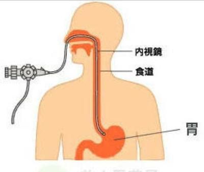 十二指腸液檢查的操作流程：十二指腸檢查的操作流程 其他寵物 第4張