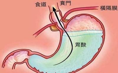 十二指腸液分析常見異常：十二指腸液分析 其他寵物 第1張