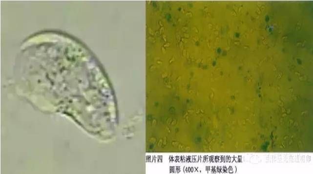 魚鲺病早期癥狀識(shí)別技巧：如何有效治療魚鲺病 其他寵物 第1張