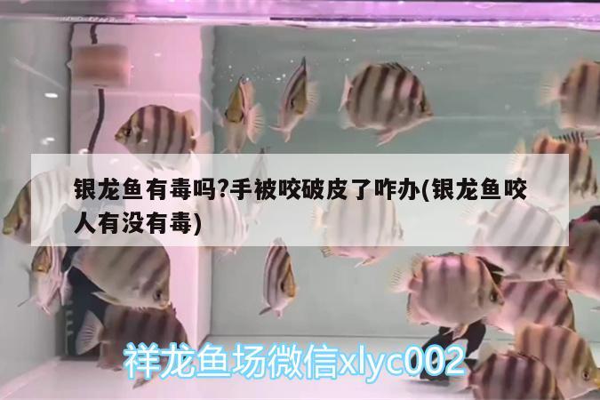 銀龍魚有毒嗎?手被咬破皮了咋辦(銀龍魚咬人有沒有毒) 銀龍魚百科