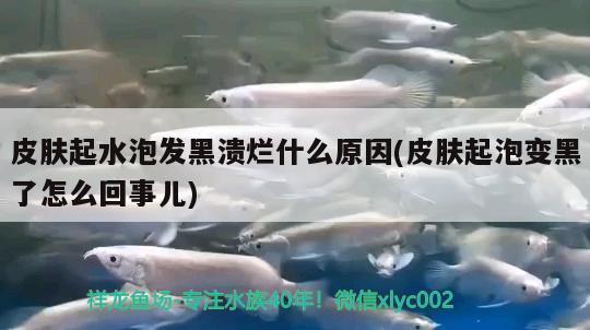 皮膚起水泡發(fā)黑潰爛什么原因(皮膚起泡變黑了怎么回事兒) 觀賞魚